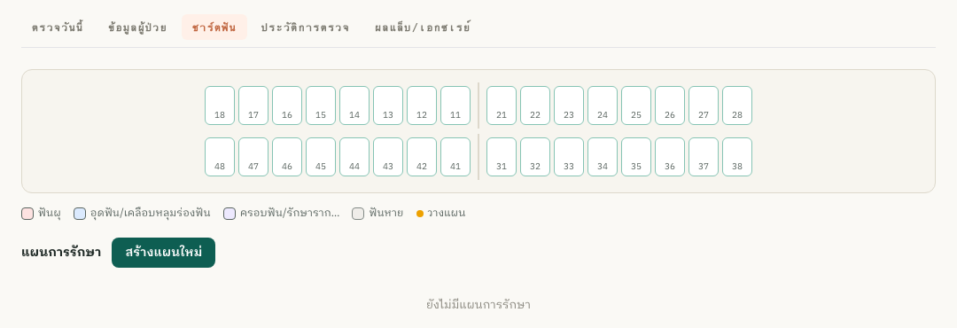ชาร์ตฟันกราฟิก + แผนการรักษา
